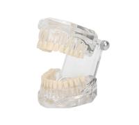 RuiJOTWAT Dental Model, Transparent Acrylic Tooth Denture Model, Visible Gum Demonstration, For Teaching, Oral Care Education