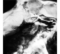 Saffronkeira - A New Life