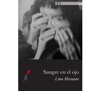 Sangre en el ojo