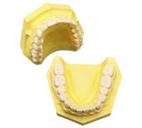 SaryEdge Dental Training Mouth Plaster Upper and Lower Jaw Model Plaster Base Resin Tooth Dental Model for Study Teaching,White,Yellow,Yellow