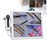 Scalp Camera 1000MP with Integrated Image Storage, Rechargeable Battery for Salon and Home Use, 15-inch Display, Ideal for Hair and Scalp Analysis