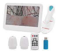 Scalp Camera with 12 Inch HD Screen, Skin Hair Analyzer with 50X/200X Lenses, High-Definition Scalp Analysis Machine, Profesional Skin Diagnosis Machine for Home & Salon Use