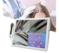 Scalp Detector and Hair Follicle Analyzer, Multi-Functional 70x/200x Dual Heads, Skin Analyser Machine for Home and Beauty Salon Use, 15 Inch