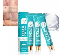 Scar Repair Cream,Repair Scar Cream,Advance Scar Gel,Scar Healing Cream,Scar Remover Cream,Scar Removal Cream,Deep Repair Skin Smooth,Suitable for All Skin Types (3 Pcs)