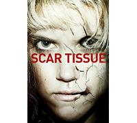 Scar Tissue
