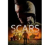 SCARS