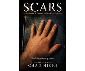 SCARS: FINDING FAITH THROUGH LIFE'S HARDEST TRIALS: 1