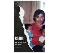 SCARS: From Broken to Built: A Blasian Man’s Journey Through Pain, Purpose, and Peace