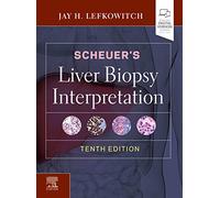 Scheuer's Liver Biopsy Interpretation