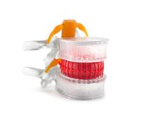 Science Transparent Spine Model Human Anatomy Lumbar Disc Herniation Demonstration Spine Model