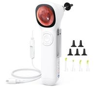 ScopeAround Wireless Digital Otoscope with IPS Screen, 720p HD Smart Visual Ear Camera, Ear Scope Otoscope Camera with 6 LED Lights, Ear Wax Removal Tool Camera, Plug & Play