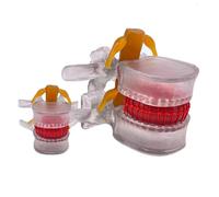 SdaryWare Anantomical Lumbar Spine Model - Educational Lumbar Vertebra Model with Nerve Lumbar Intervertebral Disc - Removable Lumbar Spine for Medical Teaching Display,Yellow,5inch,Clear-5inch