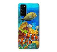 Sea Seabed Fish Corals Underwater Ocean Case Cover For Honor V30 Pro