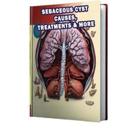 Sebaceous Cyst Causes, Treatments & More: Learn about the causes and available treatments for sebaceous cysts, common skin growths often requiring medical attention.