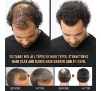 Secret Hair Care Root Activator Shampoo - Stimulates Follicles, Promotes Growth & Thickening, Strengthens Roots, Dandruff Control, 100ml