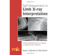 Self-assessment in Limb X-ray Interpretation: Musculoskeletal Trauma Imaging of Appendicular Skeleton