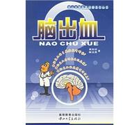 SEN doctors about disease series: Series Sun Yat-sen doctors about diseases cerebral hemorrhage