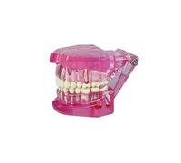 SENLIN DENTAL Transparent Disease Teeth Model with Dental Implant Bridge, Compact and Convenient Dental Models for Patient and Dental Student Education (Pink)