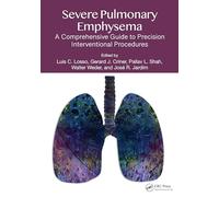 Severe Pulmonary Emphysema:: A Comprehensive Guide to Precision Interventional Procedures