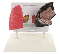 SEWACC Human Lung Anatomy Model PVC Medical Respiratory Teaching Tool for Physiology and Pathology Education in Schools and Nursing with Smoking Damage Simulation