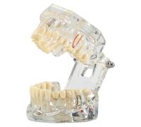 seweu Disease Teeth Model Dental Typodonts Implant Teeth Model with Removable Teeth Dentist Standard Tooth Demonstration