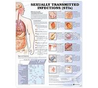 Sexually Transmitted Infections