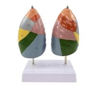 Sharplace Lung Segment Model Respiratory System Color Partition with Clear Texture Educational for Doctor Patient Communication