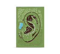 SHINERING Ear Acupuncture Print, Auricular Acupuncture, Traditional Chinese Medicine, Ear Anatomy Medical Education Poster Canvas Print A3 30Cmx40Cm No Frame