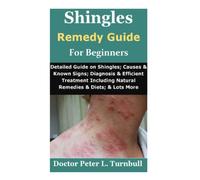 Shingles Remedy Guide for Beginners: Detailed Guide on Shingles; Causes & Known Signs; Diagnosis & Efficient Treatment Including Natural Remedies & Diets; & Lots More