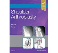 Shoulder Arthroplasty