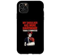 Shoulder Surgery More Hardware Fun Mens Surgery Patient Case for iPhone 11 Pro Max