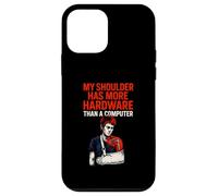 Shoulder Surgery More Hardware Fun Mens Surgery Patient Case for iPhone 12 mini