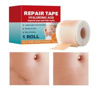 Silicone Sheets for Scars - Wound Stickers | Breathable Scar Patch,for Men Elderly Stretch Marks Face Body Breast Reduction Burn Pregnant