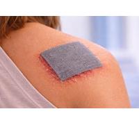 Silver-Impregnated Non-Adherent Dressings 10cm x 10cm - Pack of 3 | Antimicrobial Wound Care