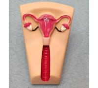 SimCoach IUD Insertion Training Model