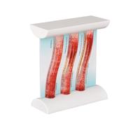 SimCoach Low-Density Lipoprotein LDL Blood Vessel Model for Medical Patient Doctor Teaching