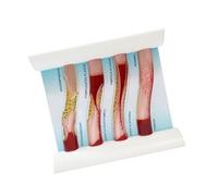 Simulated Blood Vessel Teaching Aid Vascular Model with Movable Blood Flows and Multiple Pathology Examples Enlarged Clinical Education Model