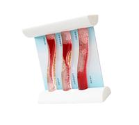 Simulated Blood Vessel Teaching Aid Vascular Model with Movable Blood Flows and Multiple Pathology Examples Enlarged Clinical Education Model
