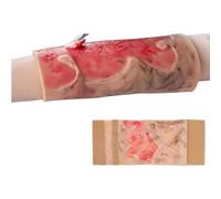 Simulated Burn Wound Model, 2-3 Degree Limb Burn Training Pad, Wearable & Reusable Burn Injury Simulation Model for Burn Care Practice, Medical Education and Teaching Demonstration