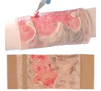 Simulated Burn Wound Model, 2-3 Degree Limb Burns Training Module, Wound Skin Model, Wearable + Reusable, Learn About Burn Care, for Medical Teaching Demonstration, for Medical Education