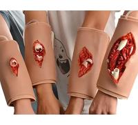Simulated Open Fracture Model,Wearable Grade 1-4 Fracture Model,Different Degree Of Fracture Treatment Dressing Model,Wound Packing and Tourniquet Tra