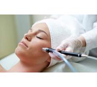 Six microdermabrasion sessions