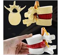 sjdoPulse 1.5X Magnification Lumbar Model - Human Spine Model Human Lumbar Vertebrae Degenerative Lumbar Medical Teaching Model for Study Teaching Display (A)