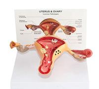 sjdoPulse Anatomical Science Model of Female Internal And External Organs - Uterine Lesion Model - Human Organ Anatomy Model Uterine Model - for Study Display Medical Teaching Model