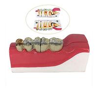 sjdoPulse Cross-Section dental Tooth Model - Demonstration Teeth Model Ight Lower Posterior Tissue medical teaching model - Adult Standard teetn model - for Study Teaching Medical Model