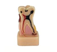 sjdoPulse Dental Care Model - Teeth Anatomical Model - Comprehensive Pathology Tooth Model - Resin MATERIAL Dental Teeth Model - for Study Display Teaching Medical Model (B)
