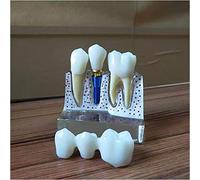 sjdoPulse Dental Implant Model - Dental Practice Implant Model - Tooth Model Dental Implant Demonstration Educational Model - for Lab Dental Demonstration Educational Analysis (C)