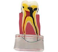 sjdoPulse Dental Teeth Study Teaching Model - Implant Teeth Model Human Mouth Teeth Model Cross-Section Demonstration Tooth Model Simulation Oral Tooth Model for Educational,A