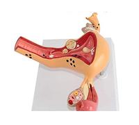 sjdoPulse Human Uterine Disease Model, Ovarian Model, Uterine Model-Doctor-Patient Communication Medical Education