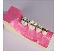 sjdoPulse Teeth Model for Education - Right Lower Back Teeth Organizational Decomposition Model - Simulation Oral Tooth Teeth Demonstration Model - for Study Teaching (A)